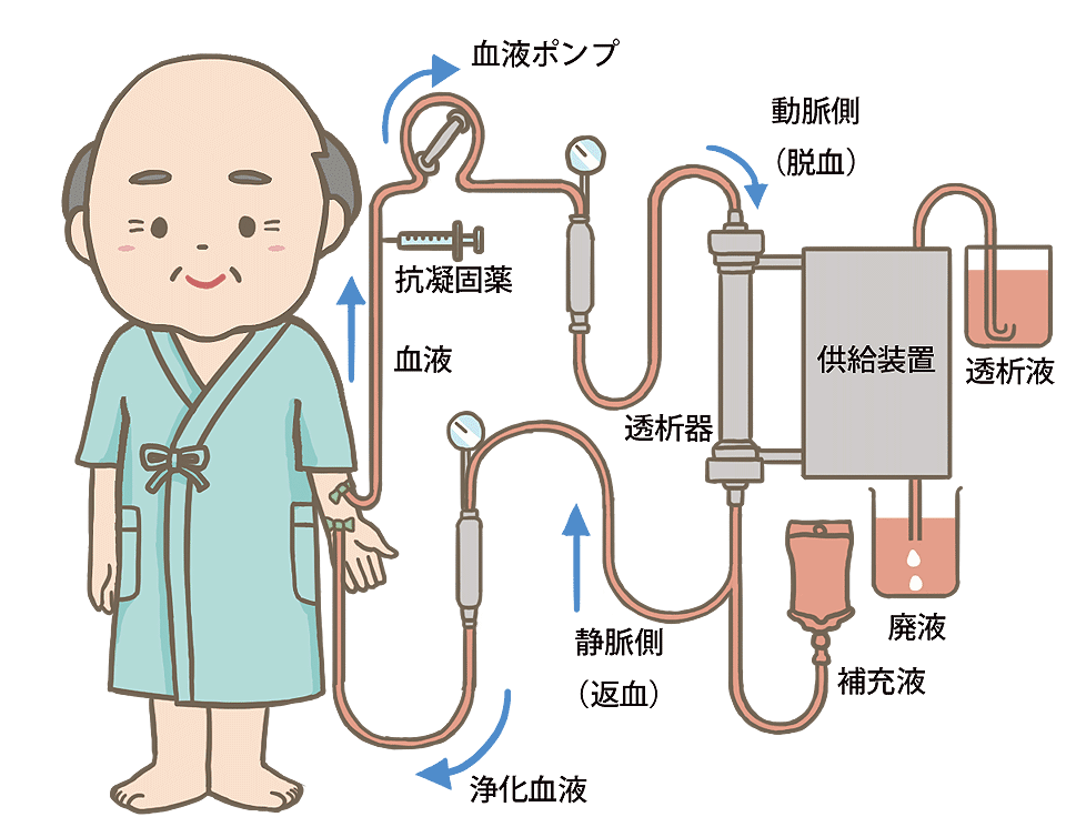 血液透析イメージ